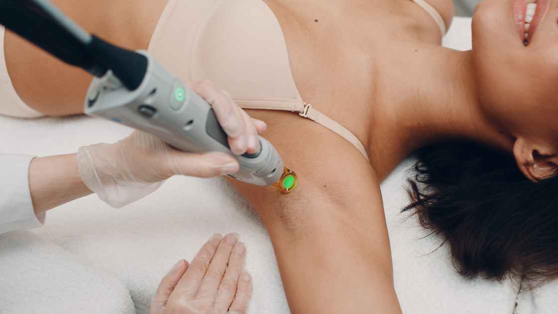 Laser Hair Removal